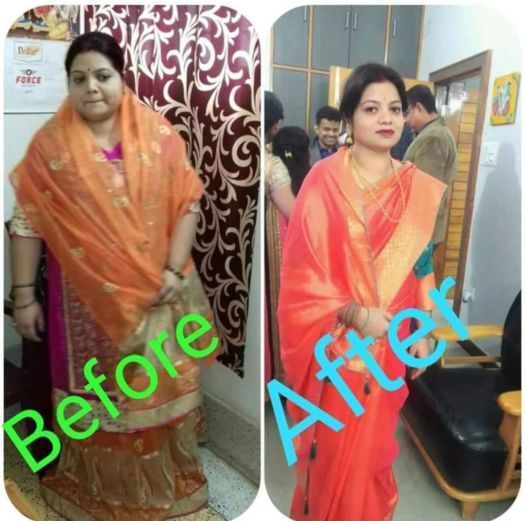 Weight Loss Transformation 1